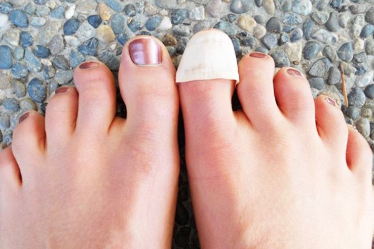 dream meaning of losing toenails
